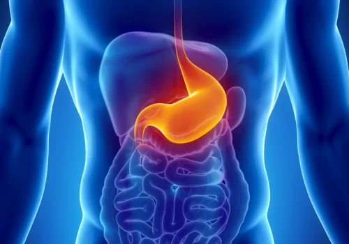 Comprehensive Stomach Care Surat