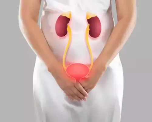 Bladder Stone Surgery Surat