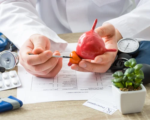 Best Prostate Surgeon Surat