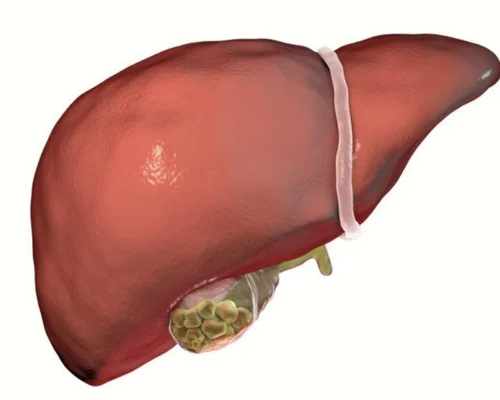 Top gallbladder specialist in Surat