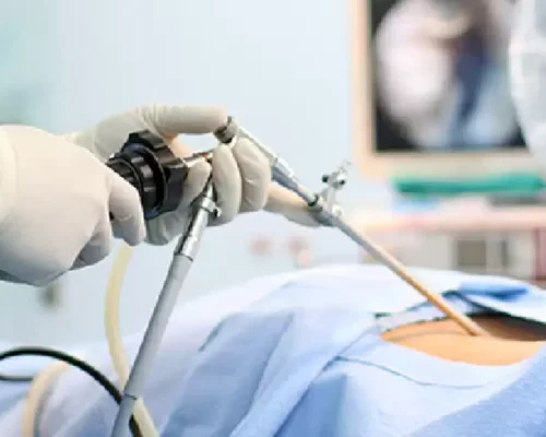 Best hospital for diagnostic laparoscopy in Surat
