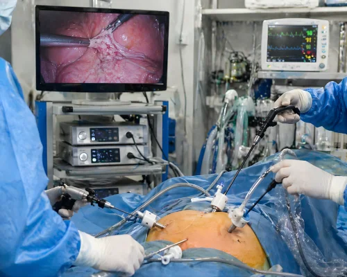 Best Stomach Surgery in Surat