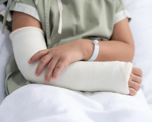 Bone Fracture Surgery Surat