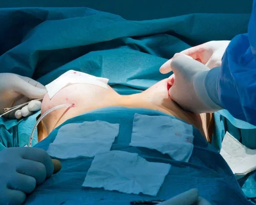 Breast Care Surgery