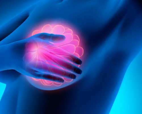 Best breast surgery doctor in Surat