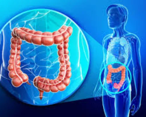 Colon Operation Surat