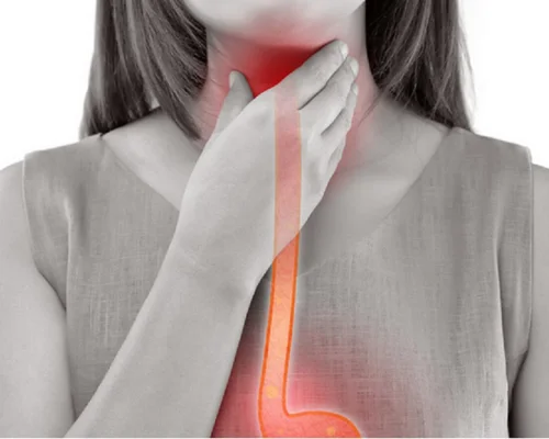 Esophageal Disease Treatment Surat