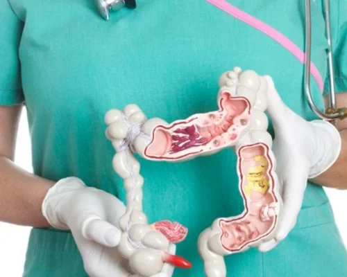Excellent laparoscopic hospital Surat