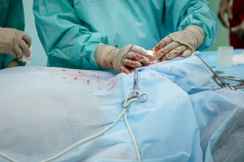 Gallbladder-Surgery