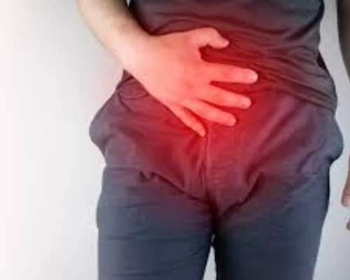Incisional Hernia Doctor Surat