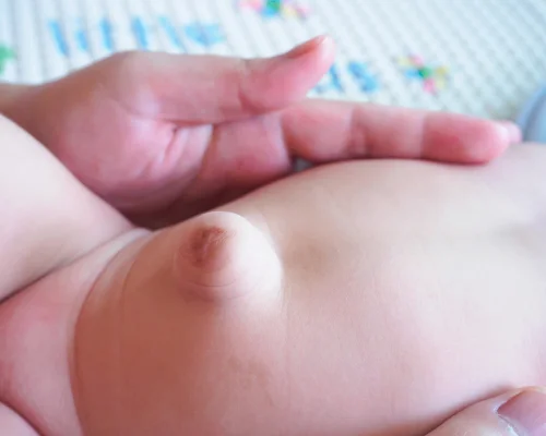 Inguinal Hernia Doctor Surat