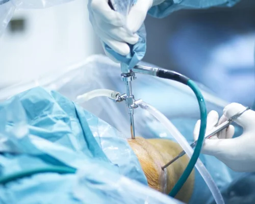 Knee Surgery Surat
