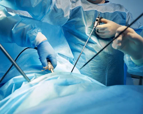 Laparoscopic gallbladder surgeon Surat