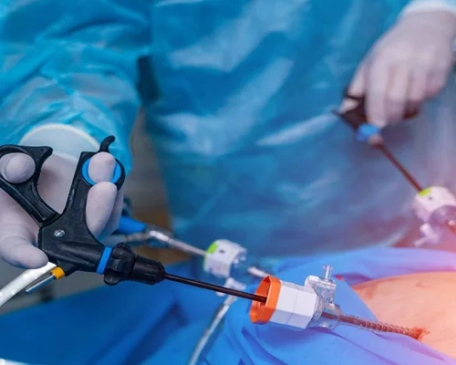 Laparoscopy Specialist in Surat
