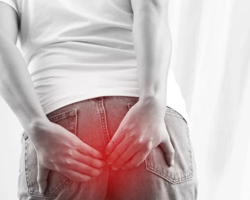 Fistula Surgery in Surat