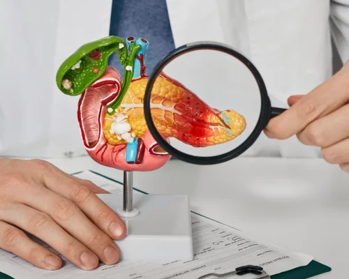 Pancreas Specialist in Surat