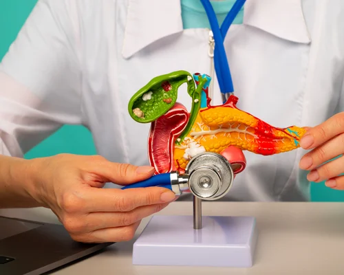 Pancreatic Care Surgery Surat