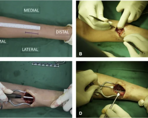 Radius Surgery Surat