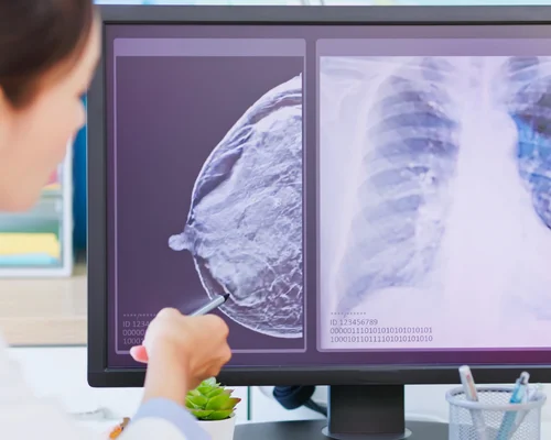 Safe breast surgery specialist Surat