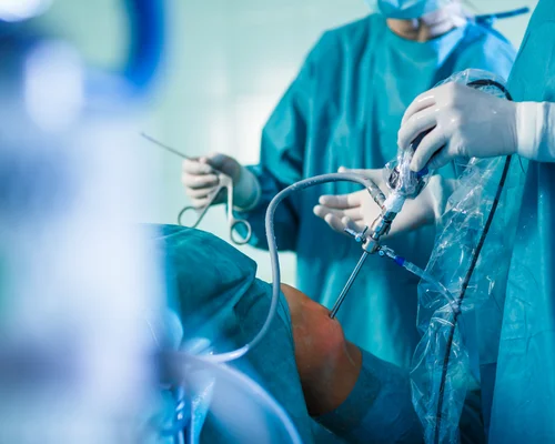 Shoulder Joint Surgery Surat