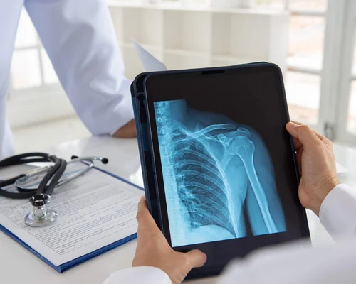 Shoulder Surgery Specialist Surat