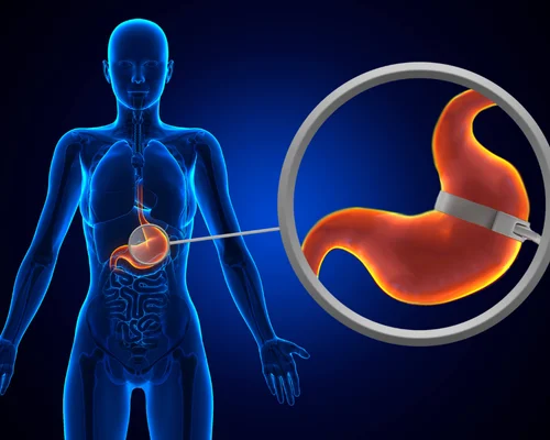 Stomach Surgery Specialist Surat