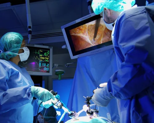 Top laparoscopic procedures Surat