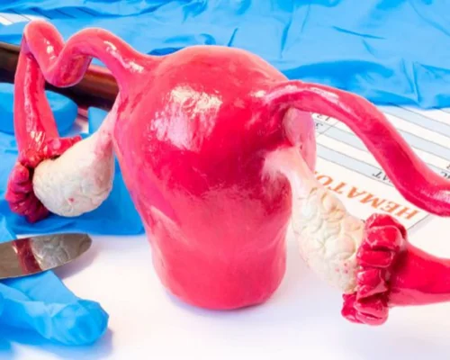 Top laparoscopic treatment Surat