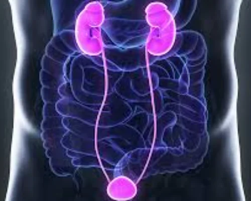 Ureteric Stone Treatment Surat