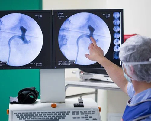 Urethra Surgery Surat
