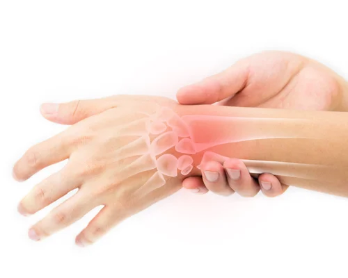 Wrist Surgery Specialist Surat