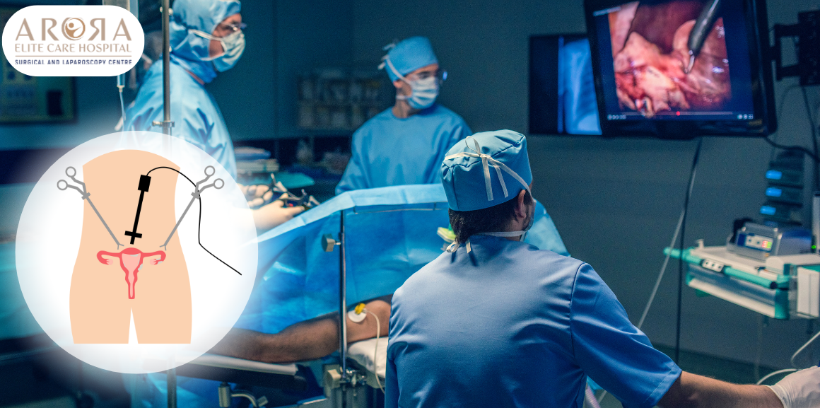 Laparoscopic Surgery Specialist in Surat