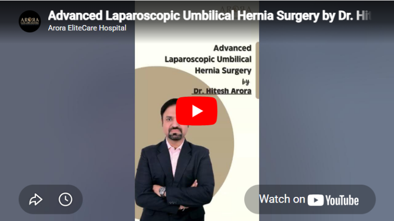 Advanced Laparoscopic Umbilical Hernia Surgery by Dr. Hitesh Arora