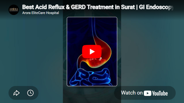 Best Acid Reflux & GERD Treatment in Surat GI Endoscopy at Arora Elite Care Hospital