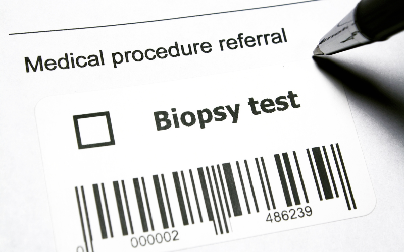 Biopsy Test Guide