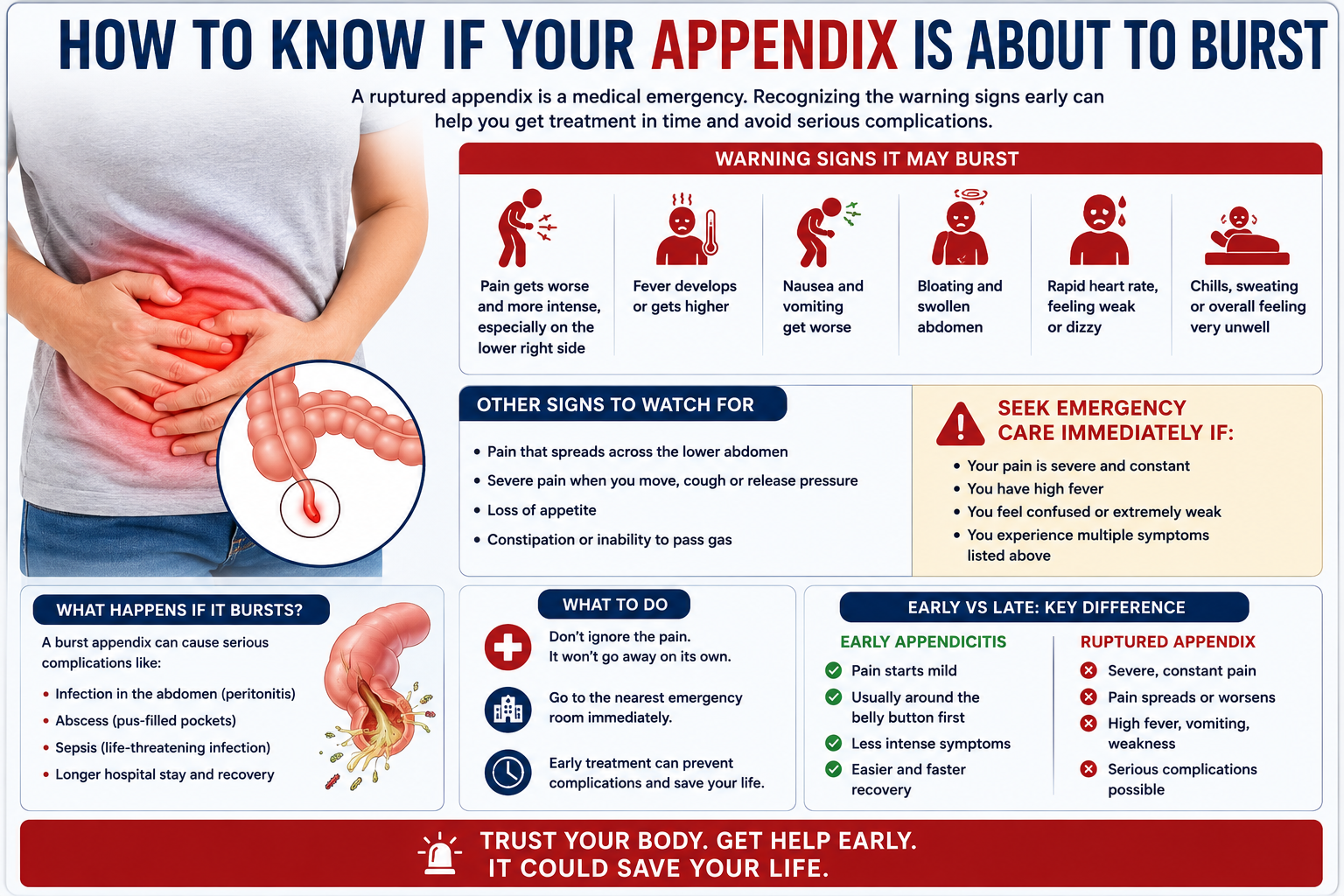 Signs Appendix About to Burst