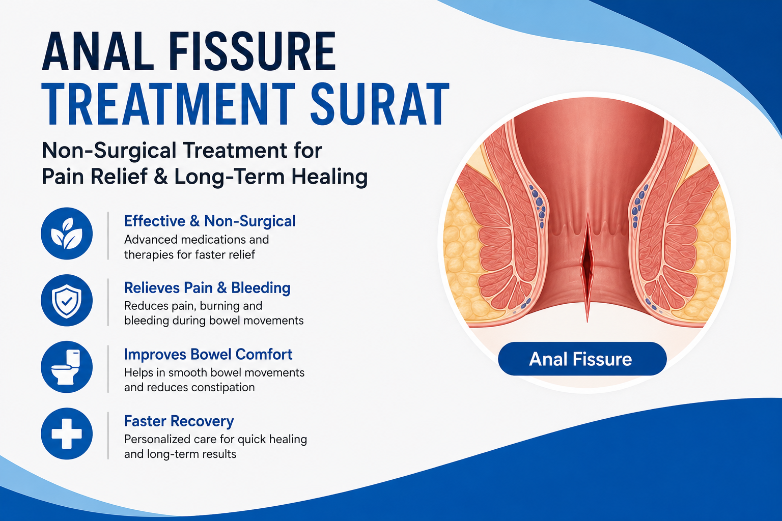 anal fissure treatment surat