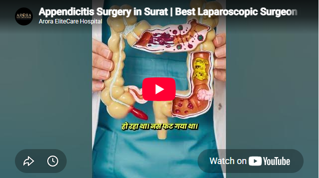 Appendicitis Surgery in Surat