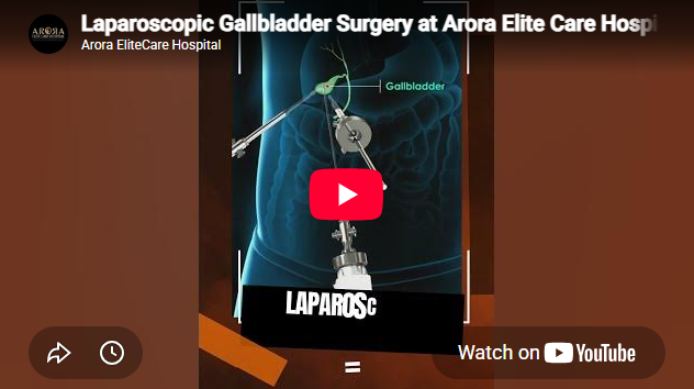Gallbladder Surgery in Surat