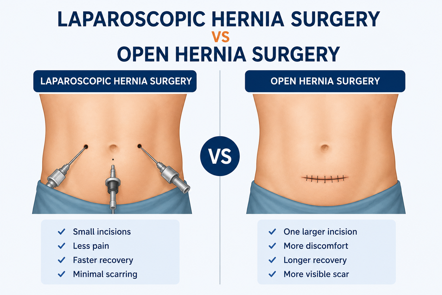 Is Laparoscopic Hernia Surgery Better Than Open Surgery