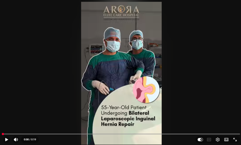 Laparoscopic Hernia Surgery in Surat