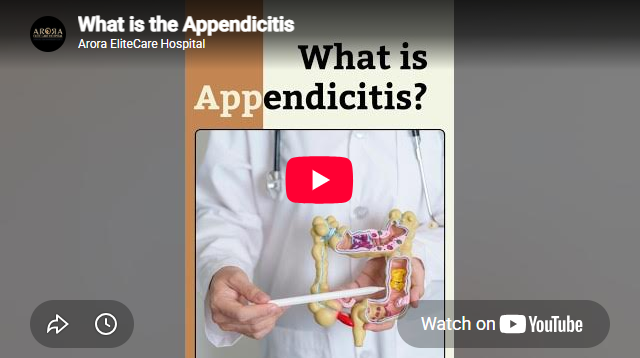 What is Appendicitis