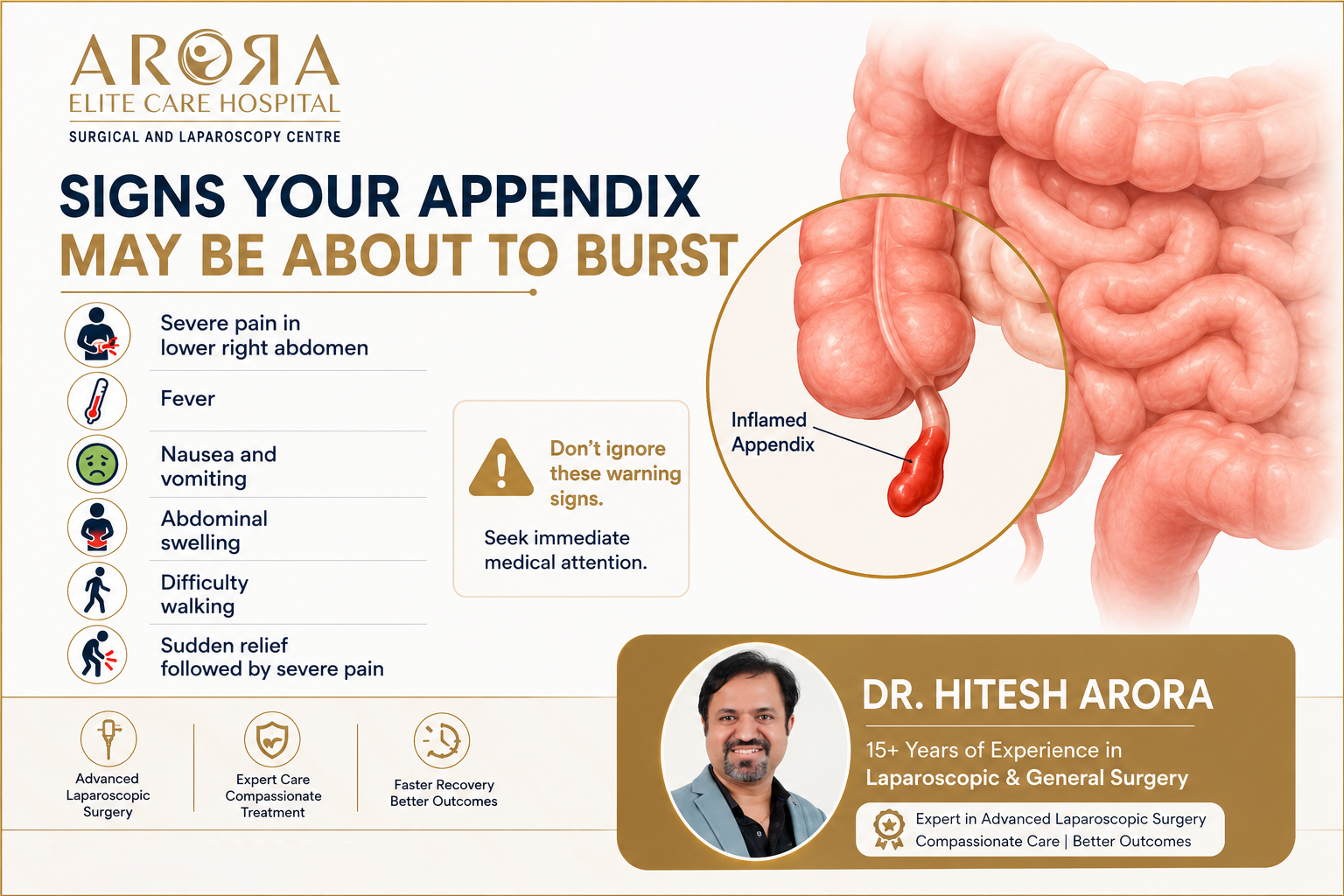 Signs Appendix About to Burst